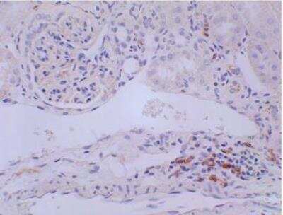 Immunohistochemistry-Paraffin: CD3 Antibody (RM0027-3B19) - Azide and BSA Free [NBP2-12159]