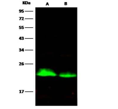 Western Blot: CD3 delta Antibody (138) [NBP2-89730]