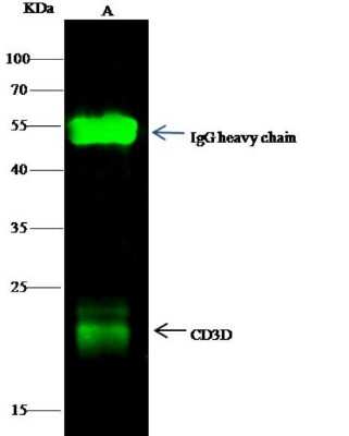 Immunoprecipitation: CD3 delta Antibody (6) [NBP2-89729]