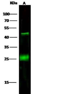 Western Blot: CD3 delta Antibody (6) [NBP2-89729]