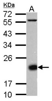 Western Blot: CD3 delta Antibody [NBP2-15795]