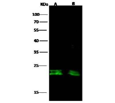 Western Blot: CD3 delta Antibody [NBP2-99673]