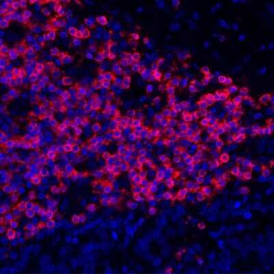 Immunocytochemistry/ Immunofluorescence: CD3 epsilon Antibody (BL-298-5D12) [NBP2-76424]