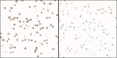 Immunocytochemistry/ Immunofluorescence: CD3 epsilon Antibody (BL-298-5D12) [NBP2-76424]