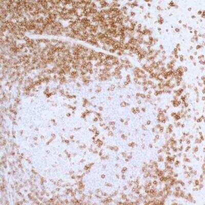 Immunohistochemistry: CD3 epsilon Antibody (BL-298-5D12) [NBP2-76424]