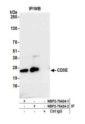 Immunoprecipitation: CD3 epsilon Antibody (BL-298-5D12) [NBP2-76424]