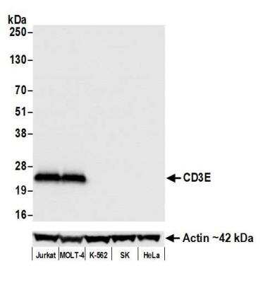 Western Blot: CD3 epsilon Antibody (BL-298-5D12) [NBP2-76424]