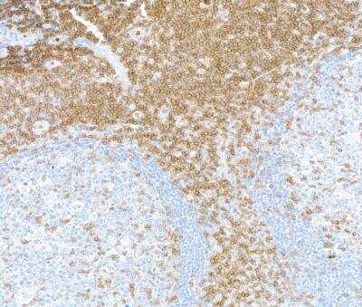 Immunohistochemistry: CD3 epsilon Antibody (BLR174J) [NBP3-14747]