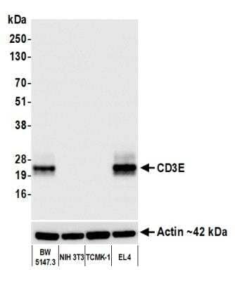 Western Blot: CD3 epsilon Antibody (BLR174J) [NBP3-14747]