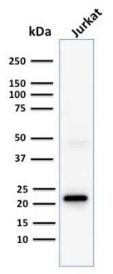 Western Blot: CD3 epsilon Antibody (C3e/1308)Azide and BSA Free [NBP2-54392]