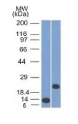 Western Blot: CD3 epsilon Antibody (C3e/1308) [NBP2-53387]