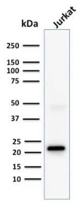 Western Blot: CD3 epsilon Antibody (C3e/1308) [NBP2-53387]