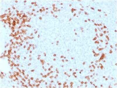 Immunohistochemistry-Paraffin: CD3 epsilon Antibody (C3e/1931) - Azide and BSA Free [NBP2-79840]