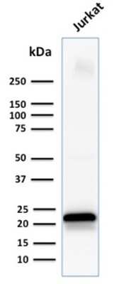 Western Blot: CD3 epsilon Antibody (C3e/1931) [NBP2-79706]