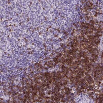 Immunohistochemistry-Paraffin: CD3 epsilon Antibody (CL1466) [NBP2-34483]