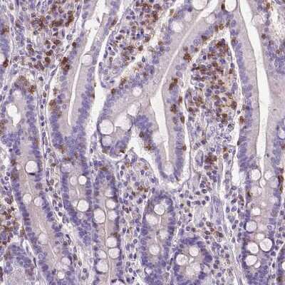 Immunohistochemistry-Paraffin: CD3 epsilon Antibody (CL1466) [NBP2-34483]