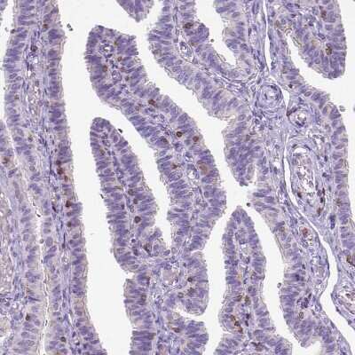 Immunohistochemistry-Paraffin: CD3 epsilon Antibody (CL1466) [NBP2-34483]