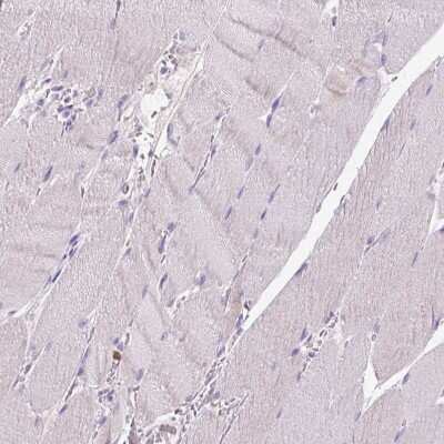 Immunohistochemistry-Paraffin: CD3 epsilon Antibody (CL1466) [NBP2-34483]