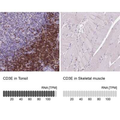 Immunohistochemistry-Paraffin: CD3 epsilon Antibody (CL1466) [NBP2-34483]