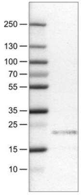 Western Blot: CD3 epsilon Antibody (CL1466) [NBP2-34483]
