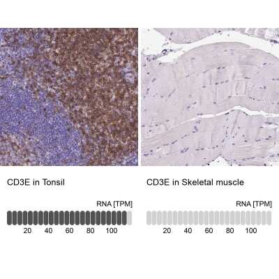 Immunohistochemistry-Paraffin: CD3 epsilon Antibody (CL1497) [NBP2-34484]