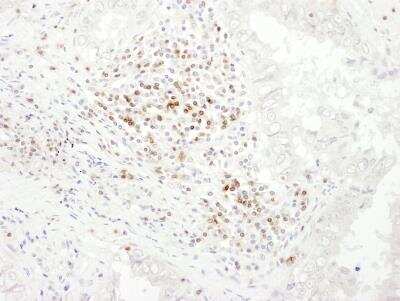 Immunohistochemistry-Paraffin: CD3 epsilon Antibody [NBP2-32282]