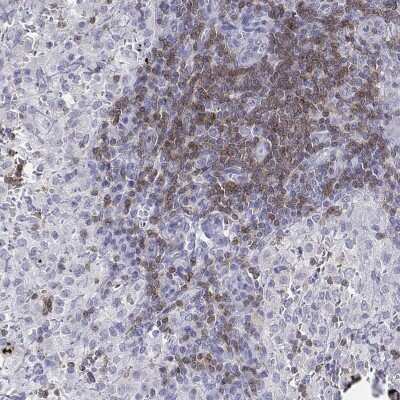 Immunohistochemistry-Paraffin: CD3 epsilon Antibody [NBP2-38479]