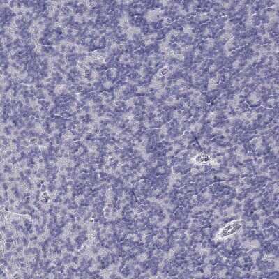 Immunohistochemistry-Paraffin: CD3 epsilon Antibody [NBP2-38479]