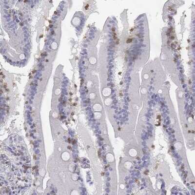 Immunohistochemistry-Paraffin: CD3 epsilon Antibody [NBP2-38479]