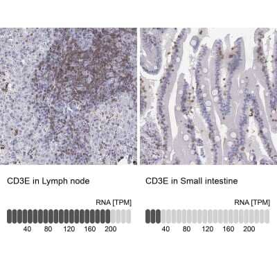 Immunohistochemistry-Paraffin: CD3 epsilon Antibody [NBP2-38479]