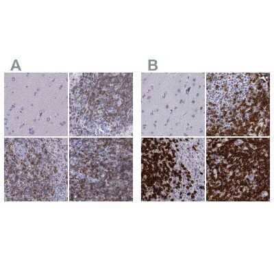 Immunohistochemistry-Paraffin: CD3 epsilon Antibody [NBP2-38479]