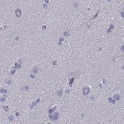 Immunohistochemistry-Paraffin: CD3 epsilon Antibody [NBP2-38479]