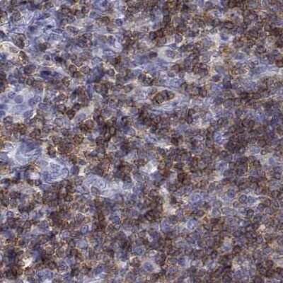 Immunohistochemistry-Paraffin: CD3 epsilon Antibody [NBP2-38479]