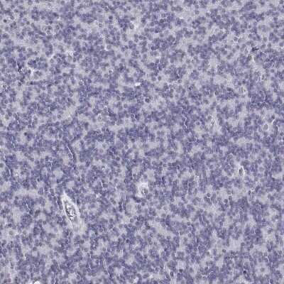 Immunohistochemistry-Paraffin: CD3 epsilon Antibody [NBP2-38520]