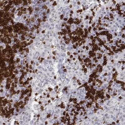 Immunohistochemistry-Paraffin: CD3 epsilon Antibody [NBP2-38520]