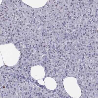Immunohistochemistry-Paraffin: CD3 epsilon Antibody [NBP2-38520]