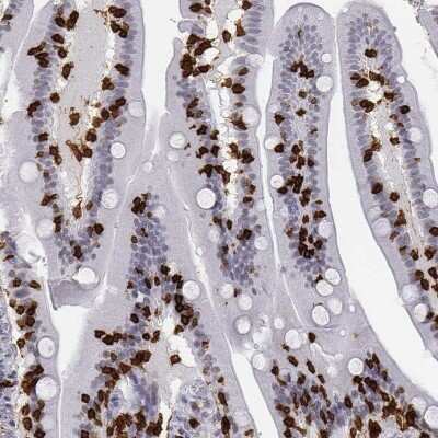 Immunohistochemistry-Paraffin: CD3 epsilon Antibody [NBP2-38520]