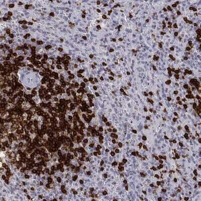 Immunohistochemistry-Paraffin: CD3 epsilon Antibody [NBP2-38520]