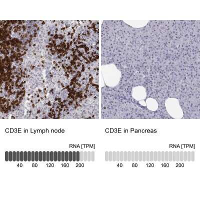 Immunohistochemistry-Paraffin: CD3 epsilon Antibody [NBP2-38520]