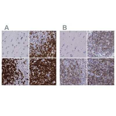 Immunohistochemistry-Paraffin: CD3 epsilon Antibody [NBP2-38520]