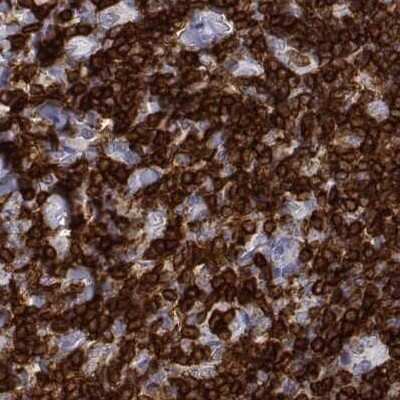 Immunohistochemistry-Paraffin: CD3 epsilon Antibody [NBP2-38520]