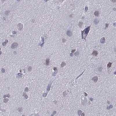 Immunohistochemistry-Paraffin: CD3 epsilon Antibody [NBP2-38520]