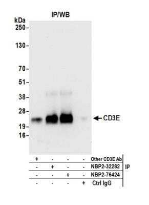 Immunoprecipitation: CD3 epsilon Antibody [NBP2-32282]