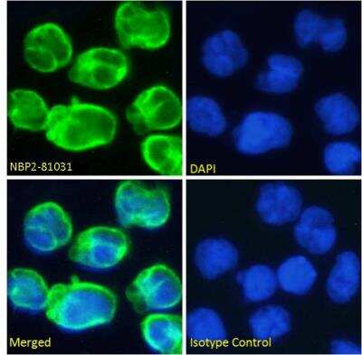 Immunocytochemistry/ Immunofluorescence: CD3 epsilon Antibody (OKT-3 (muromonab)) - Chimeric - Azide and BSA Free [NBP2-81031]