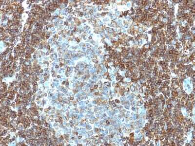 Immunohistochemistry-Paraffin: CD3 epsilon Antibody (PC3/188A) [NBP2-53386]