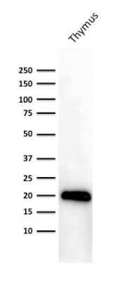 Western Blot: CD3 epsilon Antibody (PC3/188A) [NBP2-53386]