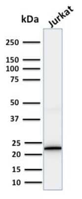 Western Blot: CD3 epsilon Antibody (PC3/188A) [NBP2-53386]