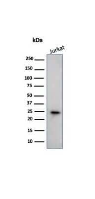 Western Blot: CD3 epsilon Antibody (PC3/188A) [NBP2-53386]