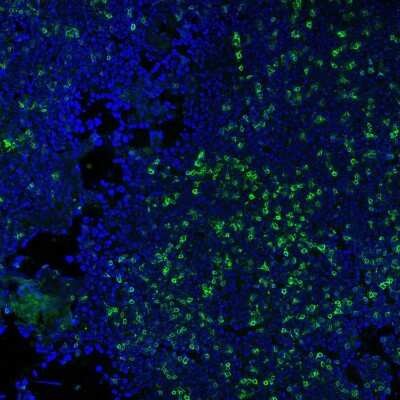 Immunocytochemistry/ Immunofluorescence: CD3 epsilon Antibody (RIV9) - Azide and BSA Free [NBP3-11471]