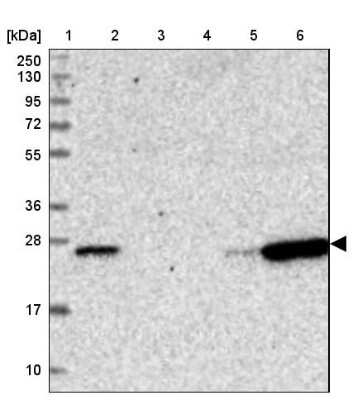 Western Blot: CD3 epsilon Antibody [NBP2-38479]
